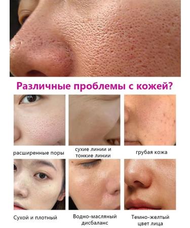 LYDIMOON Korea's face serum from extended pores on the face of 30 ml - Buy Online on GoSupps.com