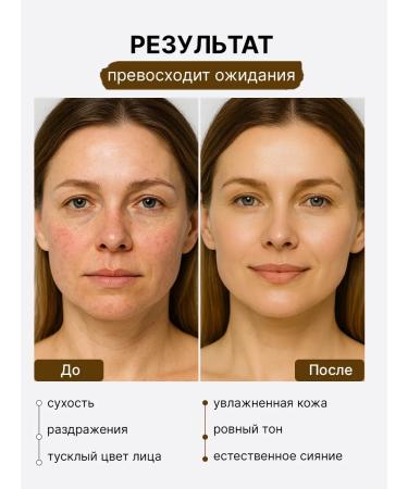 SKIN1004 Cheritus for a face restores with a centella of 50 ml of Korea - Buy Online on GoSupps.com