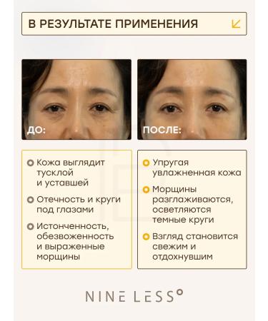 NINELESS Feature cream anti -aging from wrinkles and edema - Buy Online on GoSupps.com