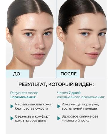 AVENE Cleanance cleansing gel and body 100ml - Buy Online on GoSupps.com