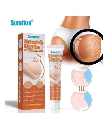 NazzShop Pregnant cream from stretch marks on the stomach of the chest after giving birth - Buy Online on GoSupps.com