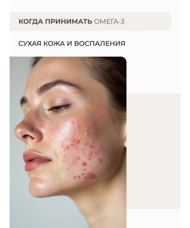 SOLOWAYS Extra omega 3 Fish fat 900 mg - Buy Online on GoSupps.com