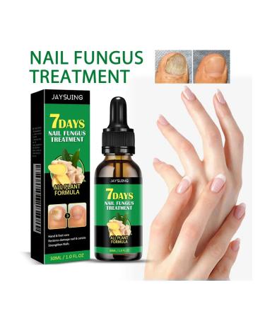 Jaysuing ginger treatment of nails - Buy Online on GoSupps.com