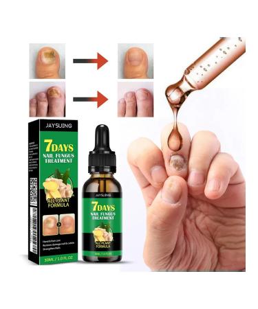 Fat care for nails restoration of damaged2 pcs - Buy Online on GoSupps.com