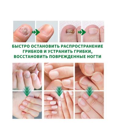 Fat care for nails restoration of damaged2 pcs - Buy Online on GoSupps.com