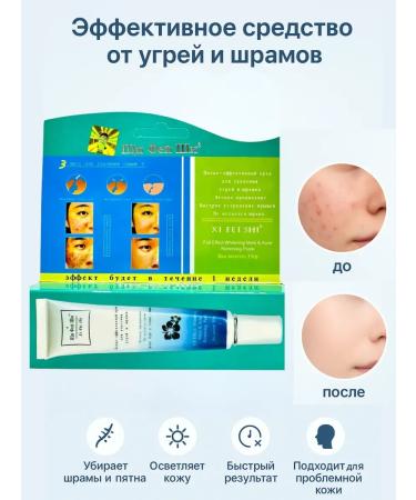 KE Acne cream and scars from post -acne effective