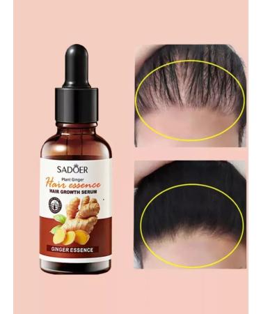 Hair oil Hair growth serum hair loss - Buy Online on GoSupps.com