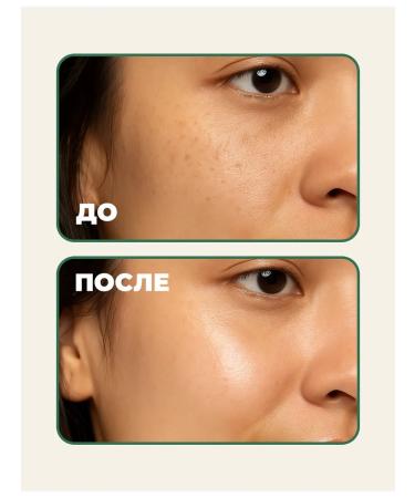 AXISY Whitening serum from age spots with 5% niacinamide - Buy Online on GoSupps.com