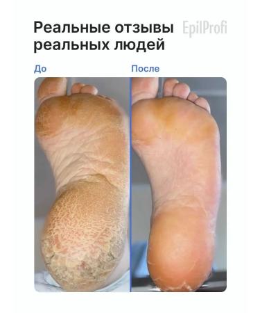 EpilProfi Gel for heels care of the urea from the urea from cracks 400 ml - Buy Online on GoSupps.com