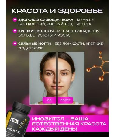 Efex Inositol for weight loss and women's health 1000 mg - Buy Online on GoSupps.com