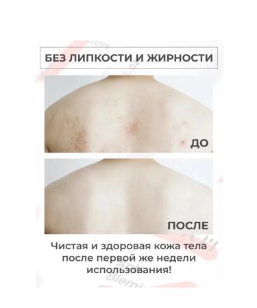 Tiam Body lotion from acne teenagers - Buy Online on GoSupps.com