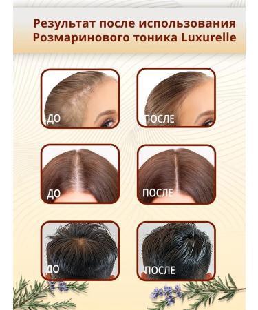 Luxurelle Rosemary tonic for hair growth - Buy Online on GoSupps.com