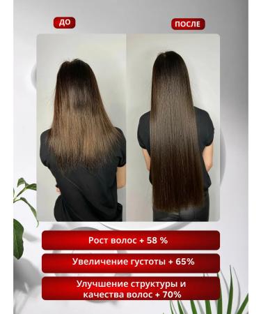 Wellness your hair Hair loss shampoo for growth - Buy Online on GoSupps.com