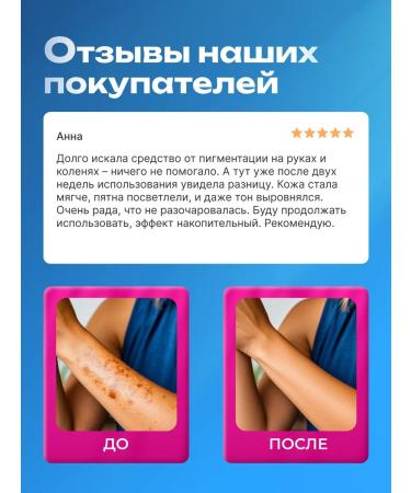 lvcos premium Whitening cream for the face and body from pigmentation with parsley - Buy Online on GoSupps.com