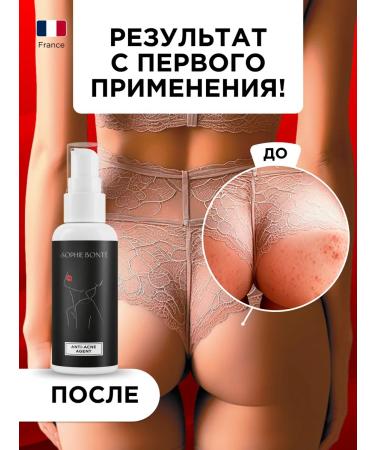 SOPHIE BONTE SB Acne cream