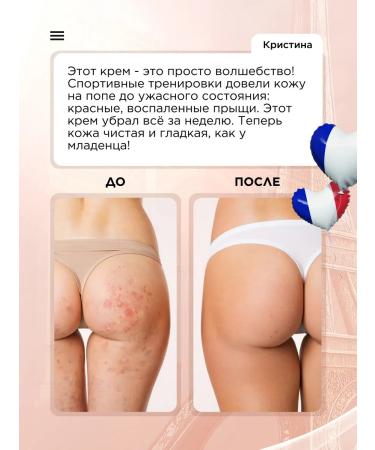 SOPHIE BONTE SB Acne cream - Buy Online on GoSupps.com