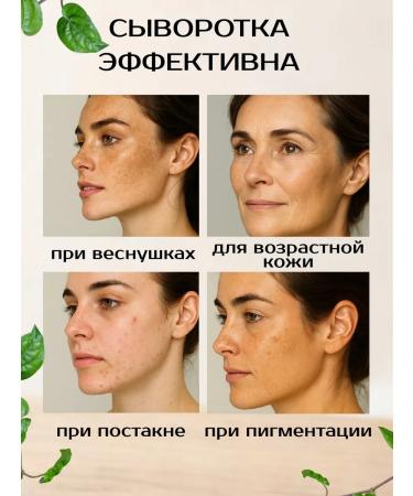 Pigmentation Cure - Buy Online on GoSupps.com