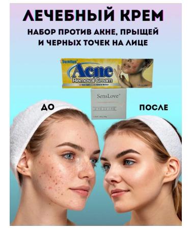 Everbloom Facial cream from acne and black dots set