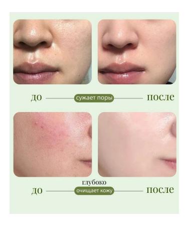 Zencolor Piling Skatka with Aloe Vera 2 pcs *200 g - Buy Online on GoSupps.com