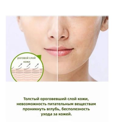 Zencolor Piling Skatka with Aloe Vera 2 pcs *200 g - Buy Online on GoSupps.com