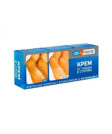 Before and After Feet cream from cracks in the feet "doi after" 50 ml