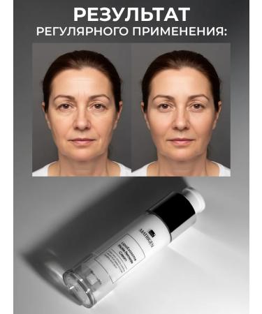 Matrigen Face cream with microeles. Speaks - Buy Online on GoSupps.com