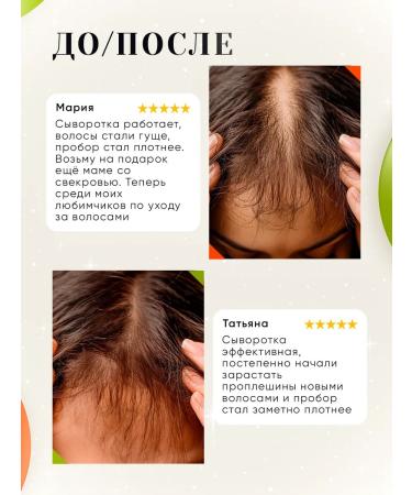 Tokishi P Hair growth serum - Buy Online on GoSupps.com