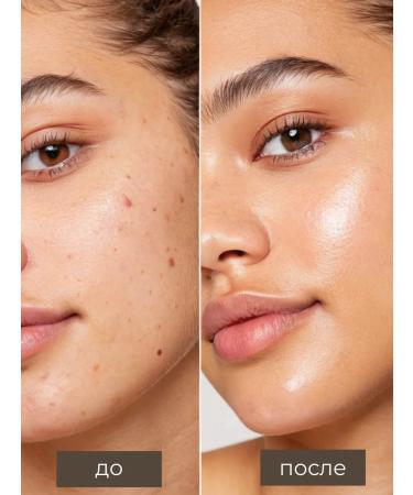 LIFTHENG Classile for the face and eyes Corrector dense tone 01 10 ml - Buy Online on GoSupps.com