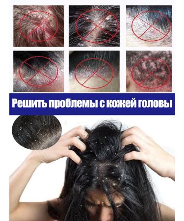 LYDIMOON Shampoo against dandruff with selenium disulfide 300 ml - Buy Online on GoSupps.com