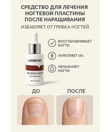 vipsvet Effective treatment of nail fungus agents - Buy Online on GoSupps.com