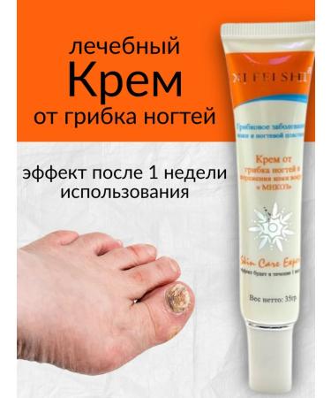 Agaline Effective therapeutic cream from nail fungus and skin lesions