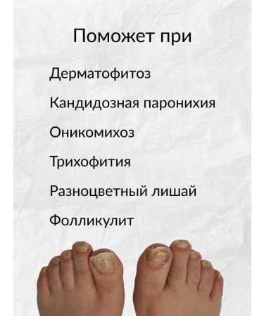 Agaline Effective therapeutic cream from nail fungus and skin lesions - Buy Online on GoSupps.com