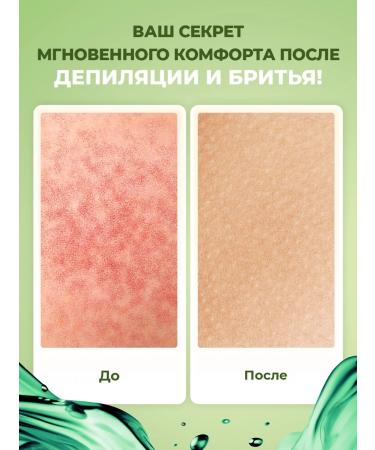 YesMix Cream gel from irritation after depilation shaving and shugaring - Buy Online on GoSupps.com