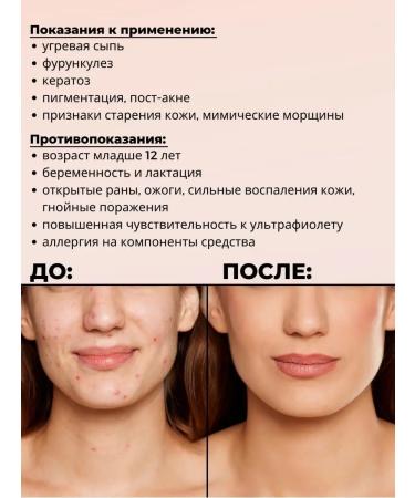 India dietary supplements Tretinoin skin care gel 0.025% menarini - Buy Online on GoSupps.com