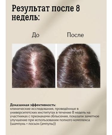 Brelil Hair loss shampoo Anti-Hair Loss 250 ml - Buy Online on GoSupps.com