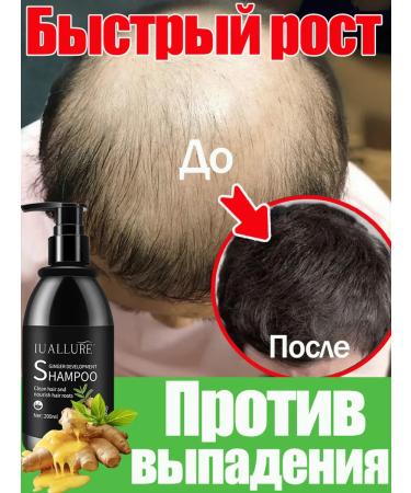 LYDIMOON hair shampoo rapid stimulation of hair growth