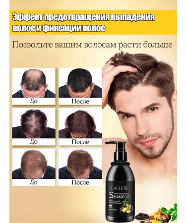 LYDIMOON hair shampoo rapid stimulation of hair growth - Buy Online on GoSupps.com