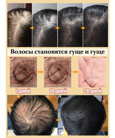 LYDIMOON hair shampoo rapid stimulation of hair growth - Buy Online on GoSupps.com