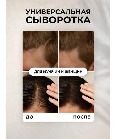 Mirsi Hair growth serum - Buy Online on GoSupps.com