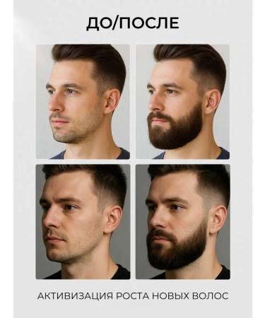 Cosmex Natural oil for the growth of beard and mustache 30 ml - Buy Online on GoSupps.com