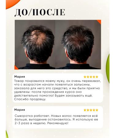 TOKISHI SB Hair growth serum - Buy Online on GoSupps.com