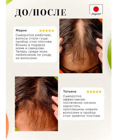 TOKISHI SB Hair growth serum - Buy Online on GoSupps.com