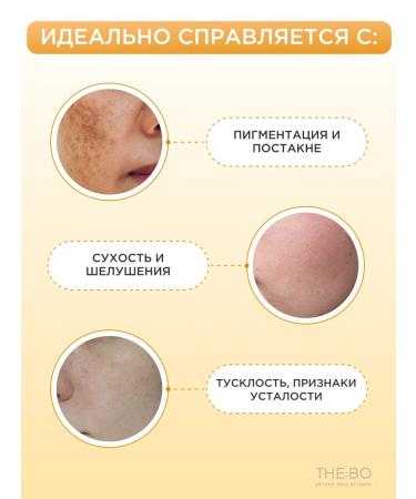 NEEDLY Moisturizing toner-spades for the face with vitamin C - Buy Online on GoSupps.com