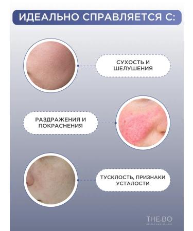 NEEDLY Moisturizing Face Cream - Buy Online on GoSupps.com