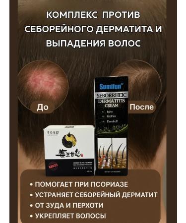 AllenGo Set for the treatment of seborrhea and hair loss