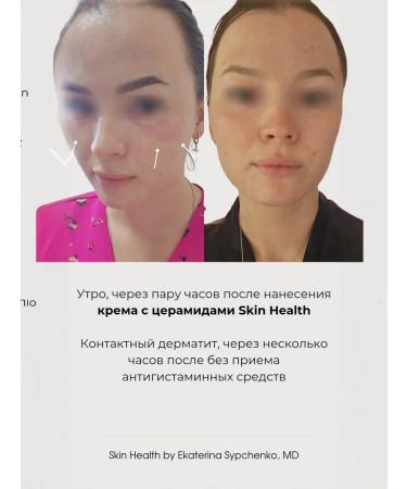 SKIN HEALTH Moisturizing face cream - Buy Online on GoSupps.com