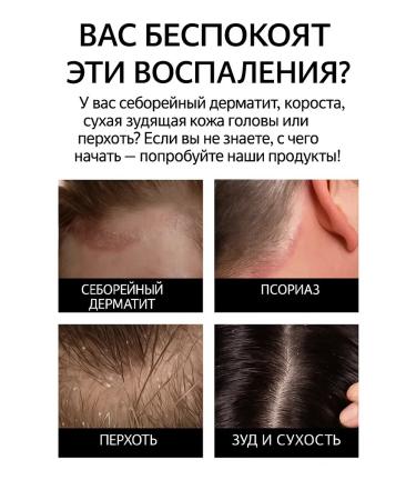 CyberJune Soap against hair loss and seborrhea cream - Buy Online on GoSupps.com