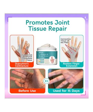 Joint neck cream relieves pain in the joints of the arms and legs - Buy Online on GoSupps.com