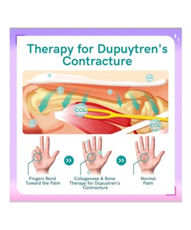 Joint neck cream relieves pain in the joints of the arms and legs - Buy Online on GoSupps.com