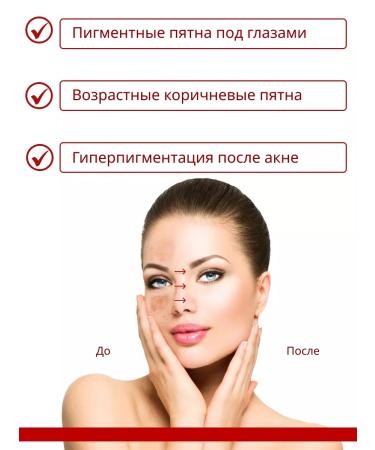 Dr Kirov / Dr Kirov Cosmetic Hyaluronic facial gel moisturizer from age spots - Buy Online on GoSupps.com